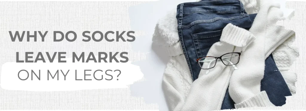 Socks Leave Marks On My Legs